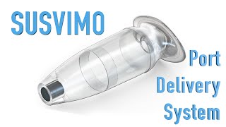 SUSVIMO: Port Delivery System for wet AMD - YouTube